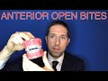 Understanding Anterior Open Bites
