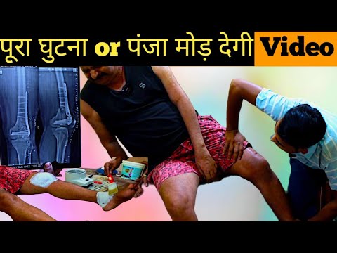 Ankle & knee bending exercises after surgery in hindi, how to cure knee stiffness, ankle exercises