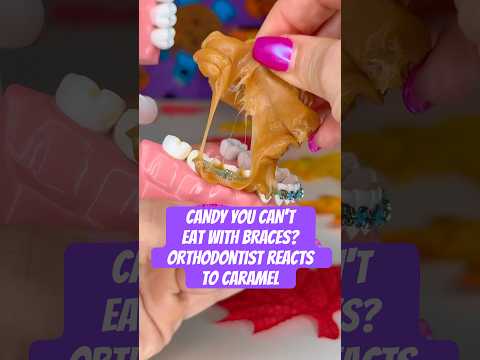 CANDY YOU CAN'T EAT WITH BRACES? Orthodontist Reacts to Caramel #braces #candy #asmr