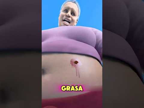 La Bala Perdida İmpactó A La Mujer😨
