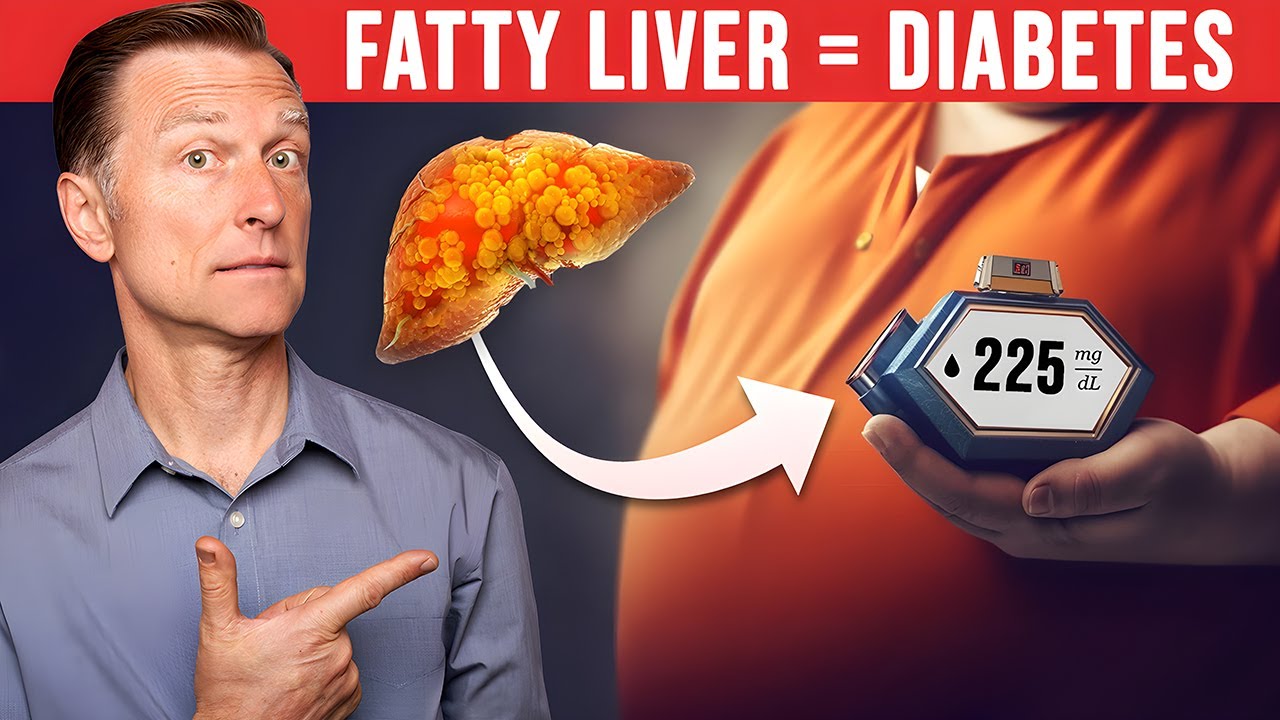 Your Fatty Liver Caused Your Diabetes