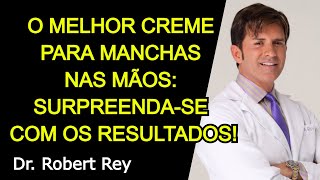 O MELHOR CREME PARA MANCHAS NAS MÃOS: SURPREENDA SE COM OS RESULTADOS! - Dr. Rey