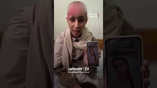"نفسي أكون جميلة مثل أطفال العالم"