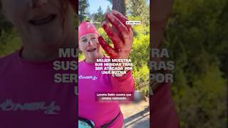 Mujer muestra las secuelas sangrientas de un ataque de nutria en el lago Tahoe