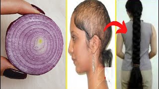 الوصفة المعجزة لانبات فراغات الشعر و الصلع في أسبوع والله النتيجة ستبهرك سيصبح مثل شعر الهنديات