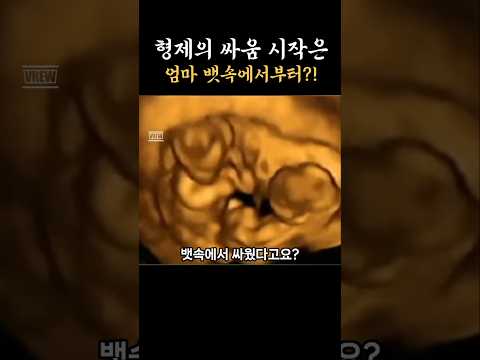 태아끼리 싸운다고? #격투기쌍둥이 #쌍둥이 #쌍둥이임신 #임신정보 #임신준비 #태교 #shorts