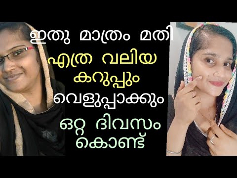 😱ഒറ്റ ദിവസം കൊണ്ട് എത്ര വലിയ കറുപ്പും വെളുപ്പിക്കാം|Skin whitening face pack homemade remedy