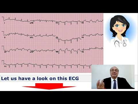 EKG Trainer (Case 4) Answer