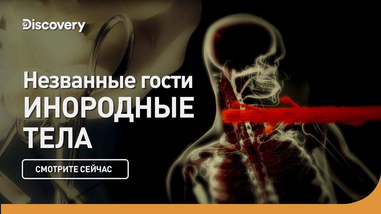 Незваные гости Инородные тела
