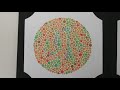 Ishihara Test and Color Blindness