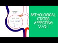 Alveolar Gas Exchange Concepts