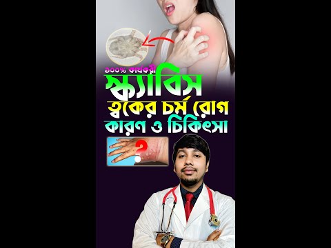 স্ক্যাবিস থেকে বাঁচার উপায় | স্ক্যাবিসের ঘরোয়া চিকিৎসা