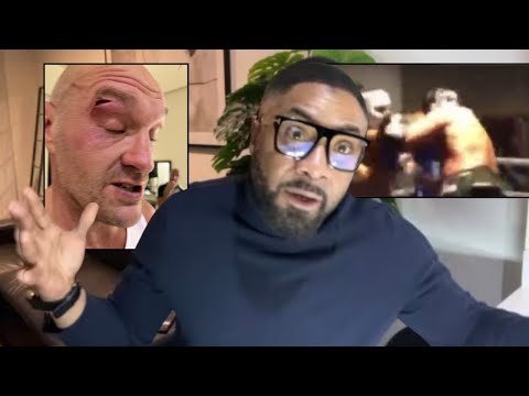 “it was clearly an elbow” spencer fearon reveals sparring partner who cut tyson fury | usyk