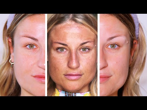 CÓMO ELIMINÉ EL 90% DE MIS MANCHAS con solo 2 PRODUCTOS | Vídeo REAL 🚫 NO PUBLI 🚫 Mi experiencia