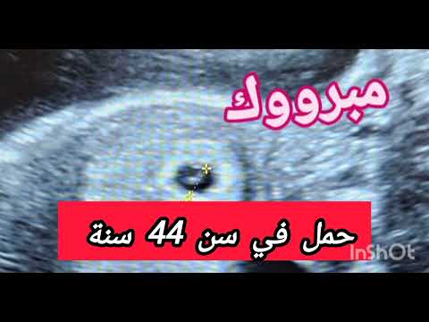 لا تقنطو من رحمة الله ...وصفة مجربة ومضمونة نجحت مع سيدة في سن 44 سنة 😭