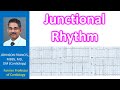 Junctional Rhythms and QRS Complexes