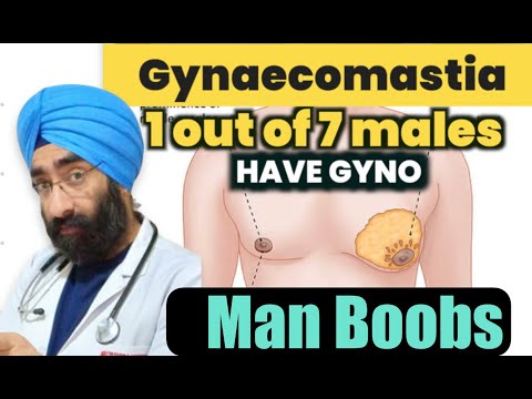 पुरुषों मे स्तन | MAN-BOOBS | Chest Fat | How to Cure |  Dr.Education