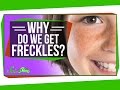 Understanding Freckles and Skin Pigmentation