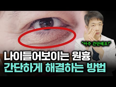 늙어 보이게 만드는 눈 밑 지방, 눈 밑 처짐 간단하게 해결하는 방법