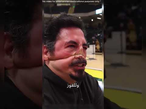 من يستطيع تحمّل الألم أكثر؟ 🤯
