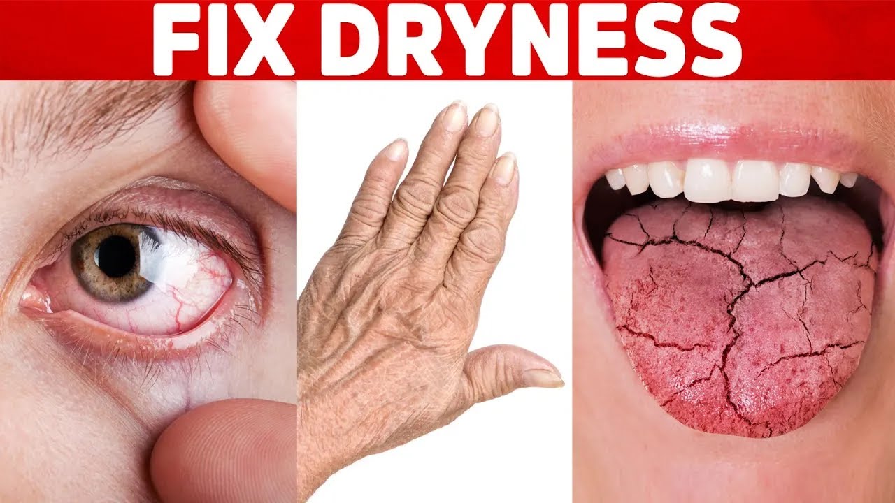 The BEST Remedies for Dry Skin, Eyes, and Mouth