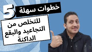 أسرع علاج للكلف وتصبغات البشرة / فيتامين تفتيح البشرة/ التخلص من البقع الداكنة