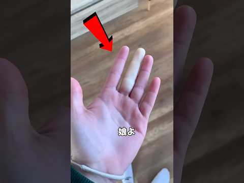 このミスで指を失うかも！ 🖐️⚠️🥶