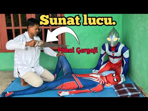 Spiderman & Ultraman Disunat Bareng! Dokter Kaget Lihat Keberanian Mereka