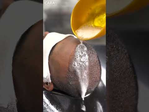 Expert Tips for First Shampoo After Hair Transplant | Cara Clinic