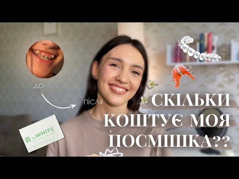 10 000 $ ЗА БРЕКЕТИ??| моя історія | фарбуємось+ відбілюємо зуби смужками Sowhite