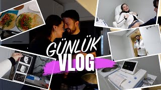 İlk Kez NST ‘ye bağlandım🤰🏼🏥 Bebeğin kilosu, Doğum planlamaları, Sancım var mı? Ve Tantuni Gecesi🍽️