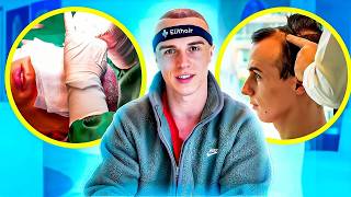 Greffe de Cheveux en Turquie : la Vérité (tout ce qu'on ne te dit pas)