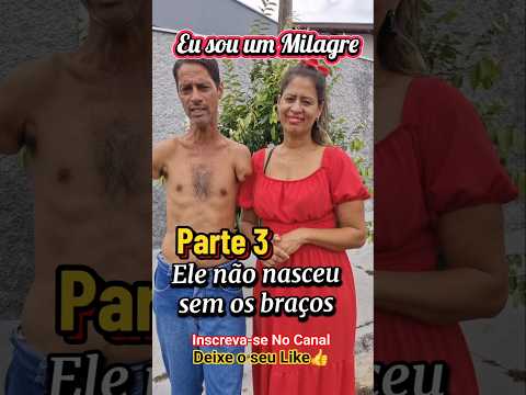 Eu sou um milagre PARTE 3.  Ele não nasceu sem os braços