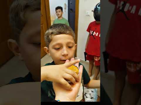 دينيز ورفقاتو اخدو حلوى الحبار الخطيرة😱 دينيز خسر فورا😰