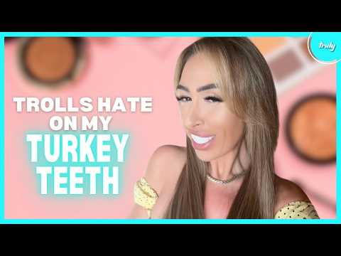 Haters Say My Turkey Teeth Are "A Joke" | HOOKED ON THE LOOK