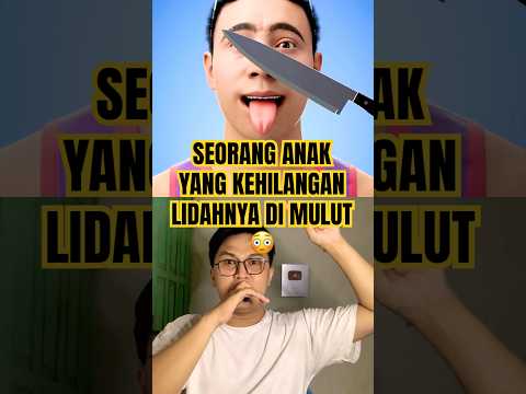 Kehilangan lidah di mulut😳 #dentist #doctor #animation #thebaldheadnthedreadpodcast