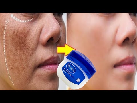 Vaseline petroleum jelly for face whitening | Petroleum jelly for pigmentation