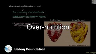 Over-Intake of Nutrients