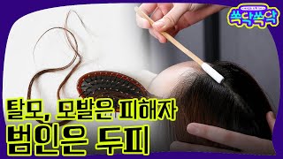 [쏙닥쏙닥] 모발은 피해자, 범인은 두피
