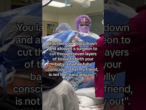 and i would do it all over again ? #shorts #labor #delivery #csection #mom #birth