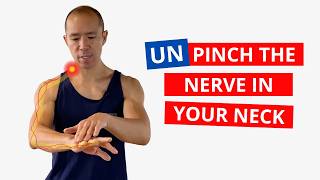 4 SAFE Exercises for a Pinched Nerve in Neck (Cervical Radiculopathy)