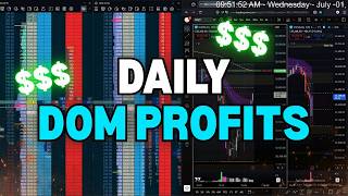 This DOM Setup Happens Almost Every Day (EASY PROFITS)