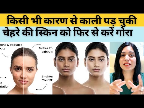 कैसे भी काली पड़ चुकी चेहरे की स्किन को गौरा करने के घरेलू उपाय | How To Get Fair Skin At Home |