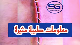 معلومات طبية مدهشة " لن تصدق كيف يلتئم الجروح "و" كيف يستخدم الصيادون الضفادع في الصيد " #shortvideo