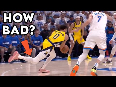 Tyrese Haliburton Calf Injury Is Concerning! Doctor Explains