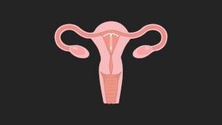 02 Contraceptives/ Sexual Education Campaign