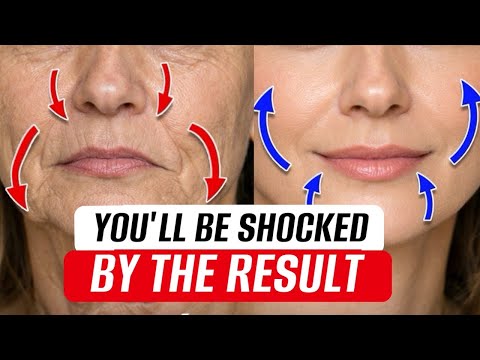 Drooping mouth corners add years to your face 😱 Fix Them Naturally