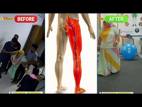 कमर से लेकर पैर तक दर्द हो तो क्या करें | Sciatic Nerve Pain | L4 L5 Disc Problem | Backpain