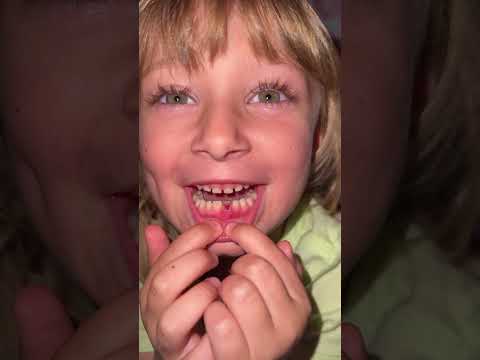 Second tooth down what a big day!!!
