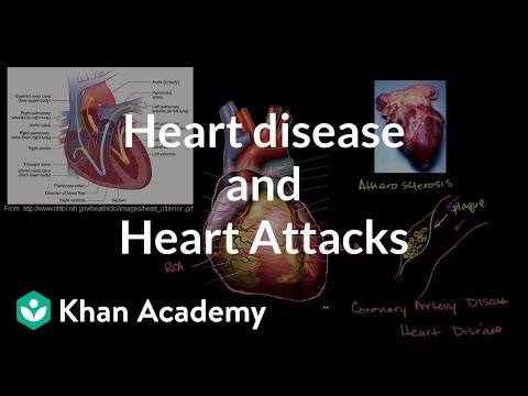 Heart Attack de The Heart Attacks Letra y Video